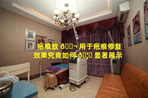 疤痕敌 🐬 用于疤痕修复效果究竟如何 🦊 显著展示